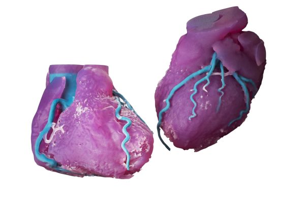 Digital material hearts